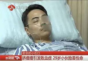 小伙挤痘痘患上败血症险些丧命,挤痘痘得败血症