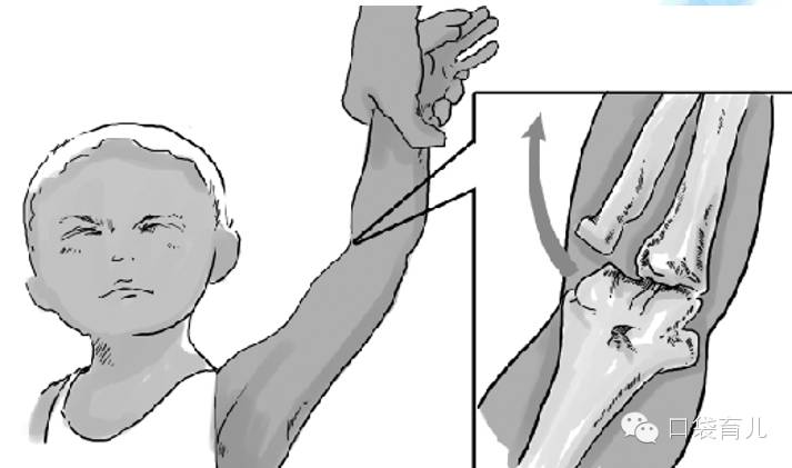 收❗宝宝外伤护理！很全面！专业医生讲述！不怕一万，就怕万一，收下来备用！