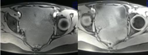 女性下腹疼痛是什么病,女性下腹疼痛的前兆