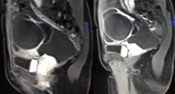 女性下腹疼痛是什么病,女性下腹疼痛的前兆