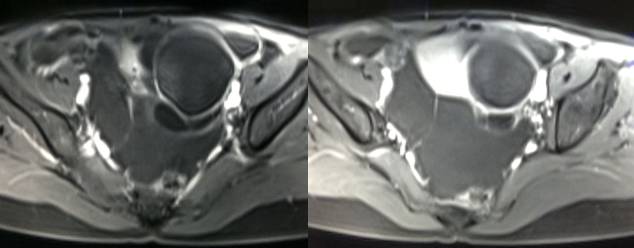 女性下腹疼痛是什么病,女性下腹疼痛的前兆