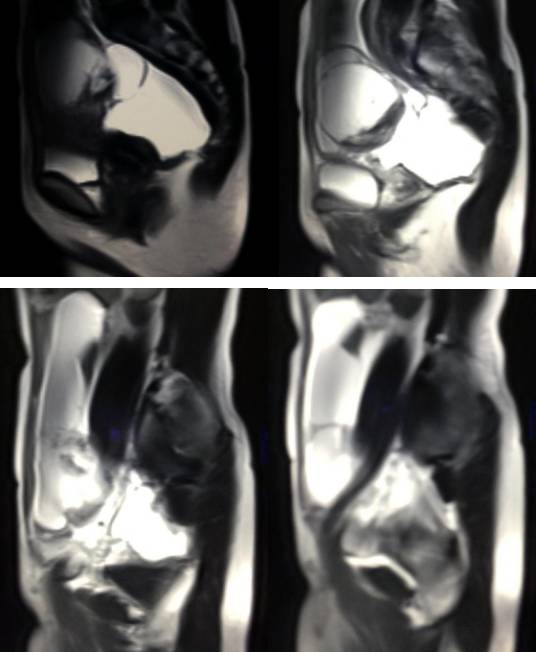 女性下腹疼痛是什么病,女性下腹疼痛的前兆