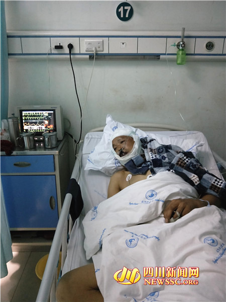 熊出没被黑熊袭击,男子上山采野菜被熊偷袭原图视频