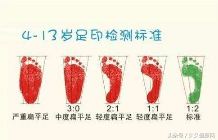 青少年穿什么鞋会导致足弓塌陷,青少年长期穿跑鞋的影响