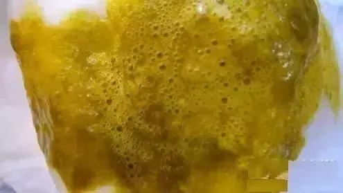 绿色便和黄色便的原因,黑绿色稀便是什么原因