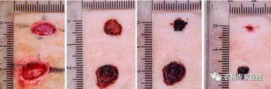李春义｜直径10厘米的伤口，1分钟止血，6天痊愈，谁是幕后推手？