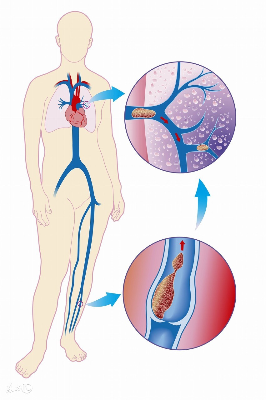胃痛主要是哪些原因造成的,胃痛主要是几种原因导致的