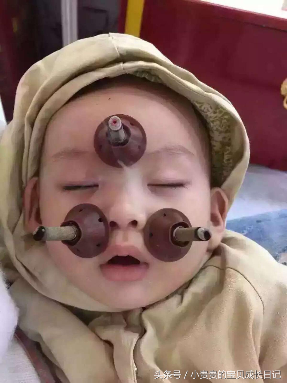 宝宝经常流鼻涕怎么办最简单方法,婴儿咳嗽流鼻涕怎么办最简单方法