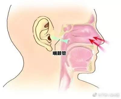飞行过程中出现耳痛怎么解决,飞行期间有一段耳朵特别疼