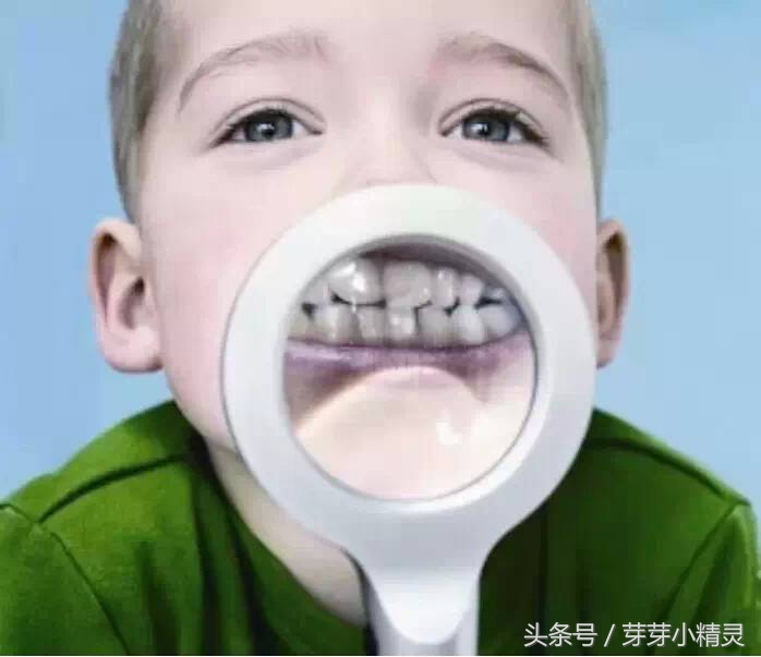 牙齿拥挤为什么会歪,牙齿拥挤的解决方法有哪几种