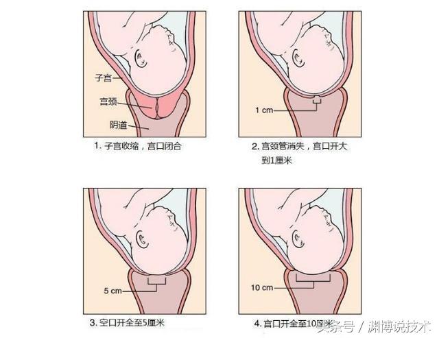顺产开十指是十根手指宽吗,顺产开十指是多少