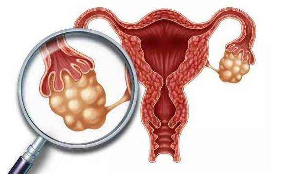 高发病率的宫颈炎患上该病真的不需要治疗吗？