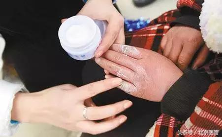 冻手冻脚怎么治疗除根,怎么冻手冻脚的