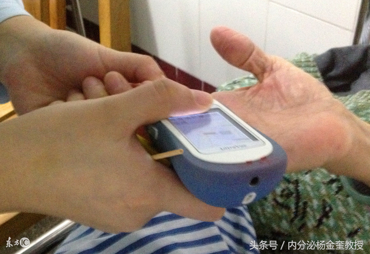 测血糖的关注事项孕妇,空腹测血糖饮食关注