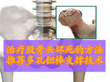 钻孔减压治疗股骨头坏死效果好吗,股骨头坏死三期轻微塌陷怎样治疗