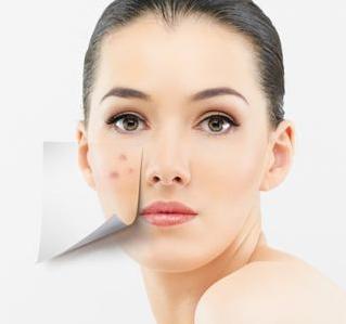 脸上长痘痘怎么办青春期学生,脸上长痘痘怎么办用什么护肤品