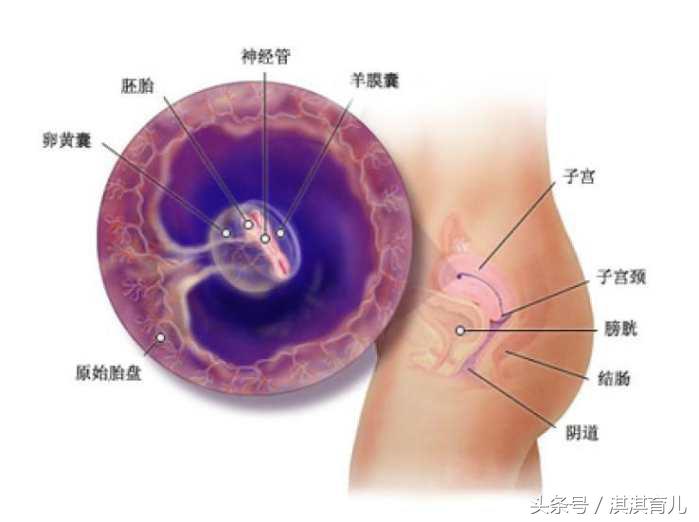 怀孕4周发现先兆流产,怀孕4周有姨妈感是怎么回事