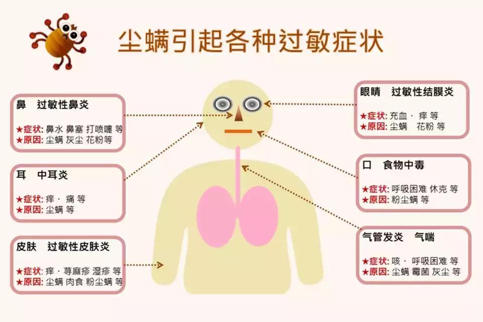 除螨仪什么牌子真的有用,除螨仪到底是什么样的好