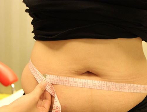 剖腹产和顺产有哪些优点和缺点,顺产那么好为什么那么多剖腹产