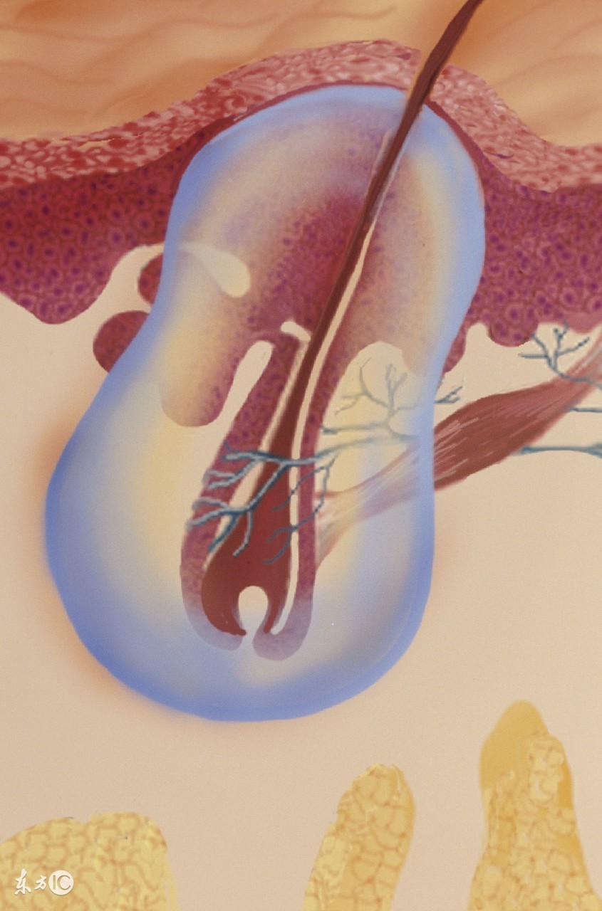 如何通过饮食来治疗毛囊炎呢