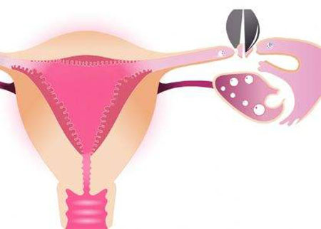 取环了怀不起孩子该怎么办,取环后怀不上孩子偏方