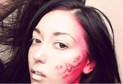 皮肤红血丝能做美容吗,汗蒸后出现血丝是怎么回事