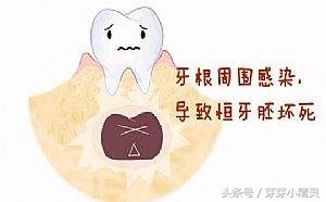 牙龈处长了不疼的小包,牙龈上起了一个小肉包的图片