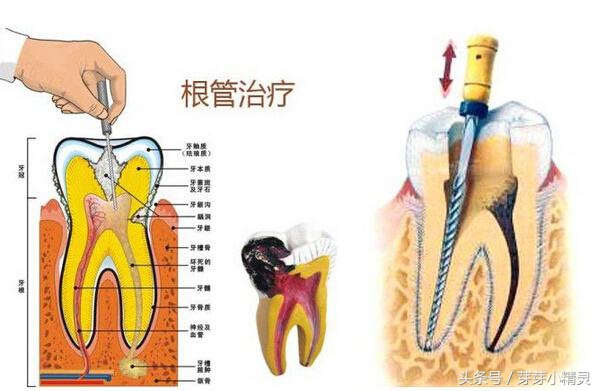 牙龈处长了不疼的小包,牙龈上起了一个小肉包的图片