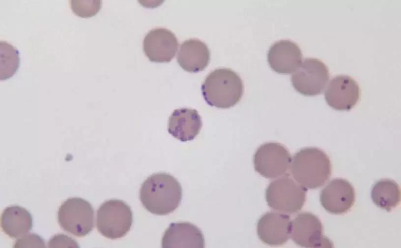 穿好奶奶织的毛裤，你仍然无法避免与风湿膏药共度晚年