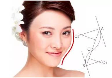 玻尿酸是瘦脸还是填充,玻尿酸填充脸颊会有提拉效果吗