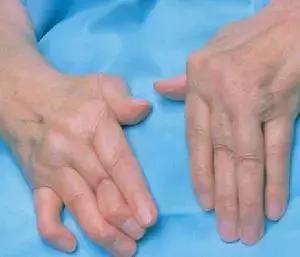 穿好奶奶织的毛裤，你仍然无法避免与风湿膏药共度晚年