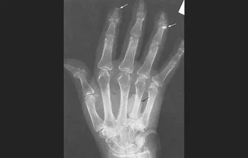 穿好奶奶织的毛裤，你仍然无法避免与风湿膏药共度晚年