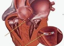 蹇冭倢绉绘,蹇冭倢姊楀蹇冭剰绉绘鑳芥椿澶氫箙