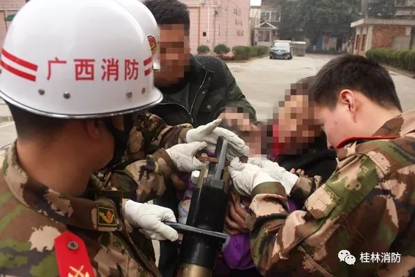 小孩不谨慎被卡住了,宝宝不谨慎被东西卡住了