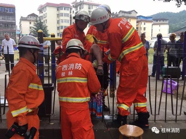 小孩不谨慎被卡住了,宝宝不谨慎被东西卡住了