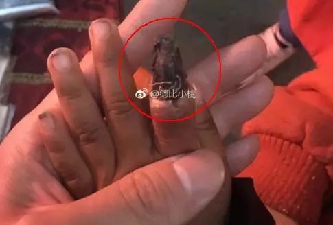 婴儿面临截肢,血泪的教训家长必知