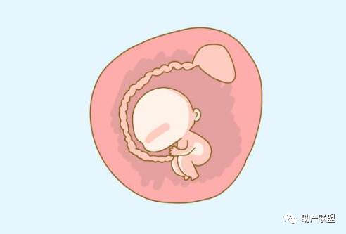 羊水栓塞的主要治疗方案,羊水栓塞诊断方法