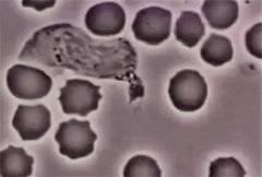 穿好奶奶织的毛裤，你仍然无法避免与风湿膏药共度晚年