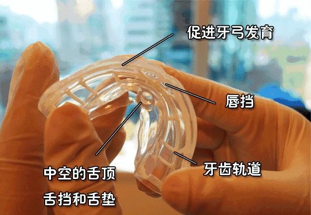 张着嘴巴睡觉会变成什么样,张着嘴睡觉会长成什么样