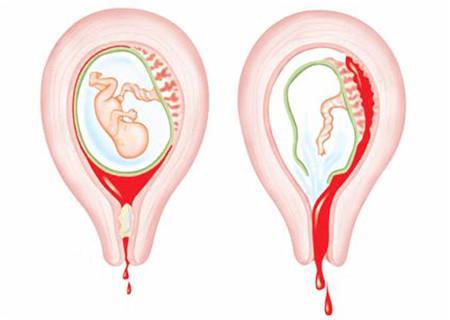 怀孕护士被小孩子踢了,护士怀孕被病人踢