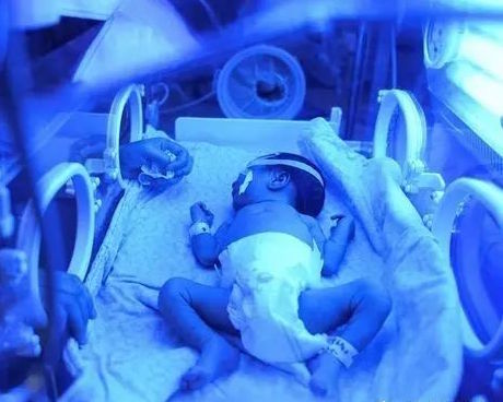 新生宝宝越来越黄,刚出生的宝宝变黄是怎么回事