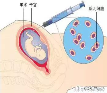 唐氏筛查无创dna和羊水穿刺哪个好,nt3.3做无创dna还是羊水穿刺