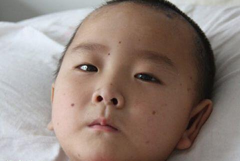 宝宝身上隐藏的“胎记”，你或许还没有发现