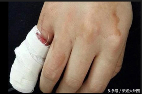 好的红酒都是软木塞吗,红酒为什么要软木塞封口