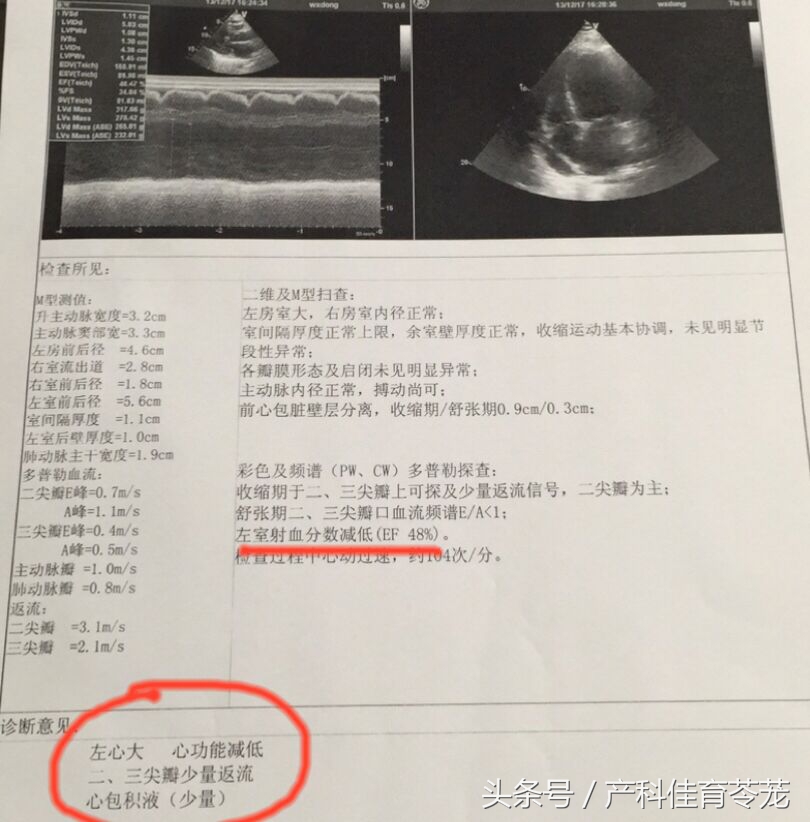 怀孕初期感冒咳嗽喉咙疼怎么办,怀孕感冒咳嗽对胎儿有什么影响