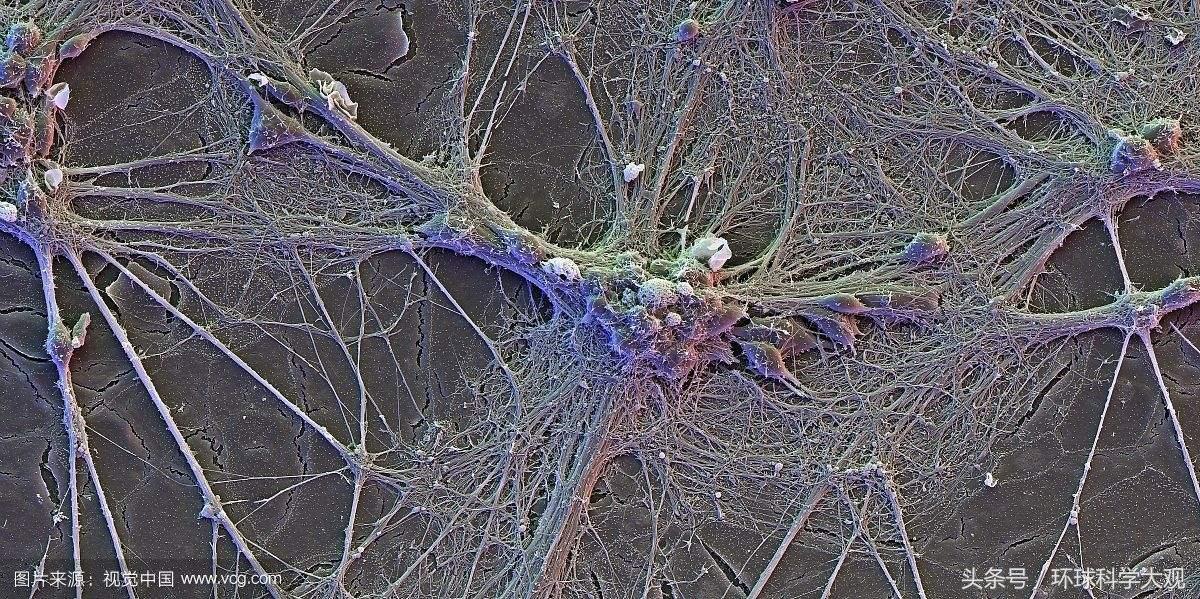 自闭症新药新突破,未来10-20年有望治愈的自闭症