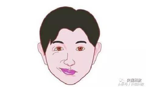 左边面肌痉挛会引起右眼皮跳动,眼皮老跳警惕面肌痉挛吃什么药