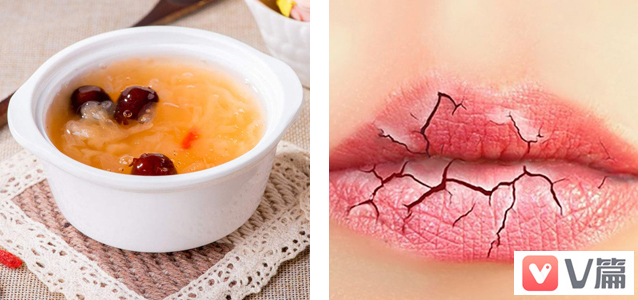 嘴唇伤口结痂怎么处理,嘴唇干裂破皮用什么药管用