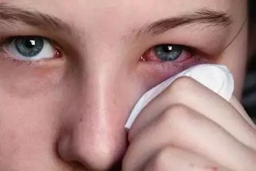 眼睛受伤急救方法,眼睛受伤急救小知识图片