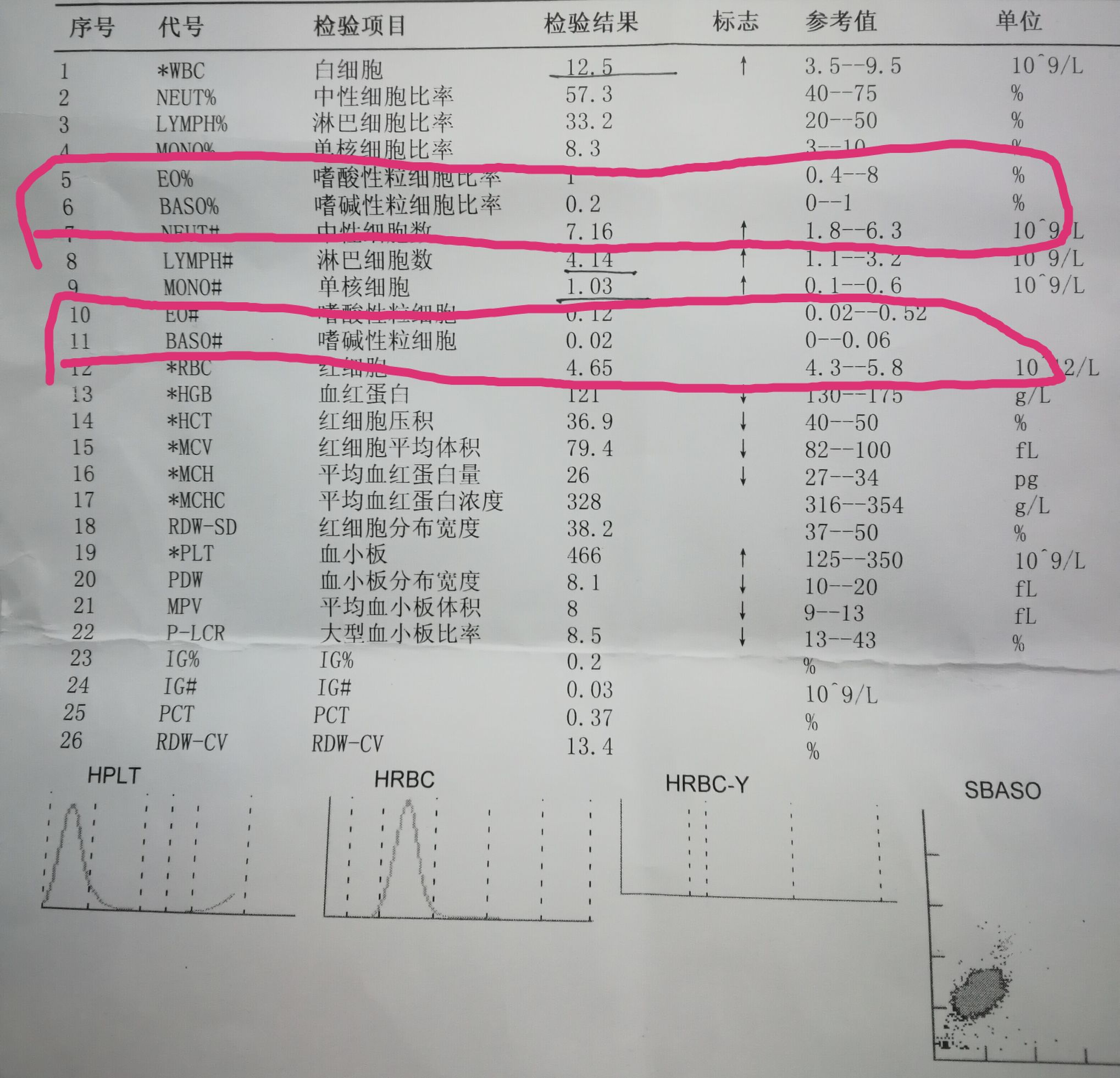 一分钟看懂化验单,化验单能看出肝功能不正常吗